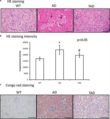 Physical Activity Protects the Pathological Alterations of Alzheimer’s Disease Kidneys via the Activation of PACAP and BMP Signaling Pathways